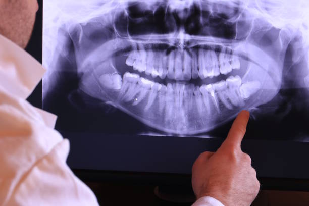 Best Tooth Infection Emergency Dentist  in Smoke Rise, AL